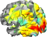 flat mapped brain