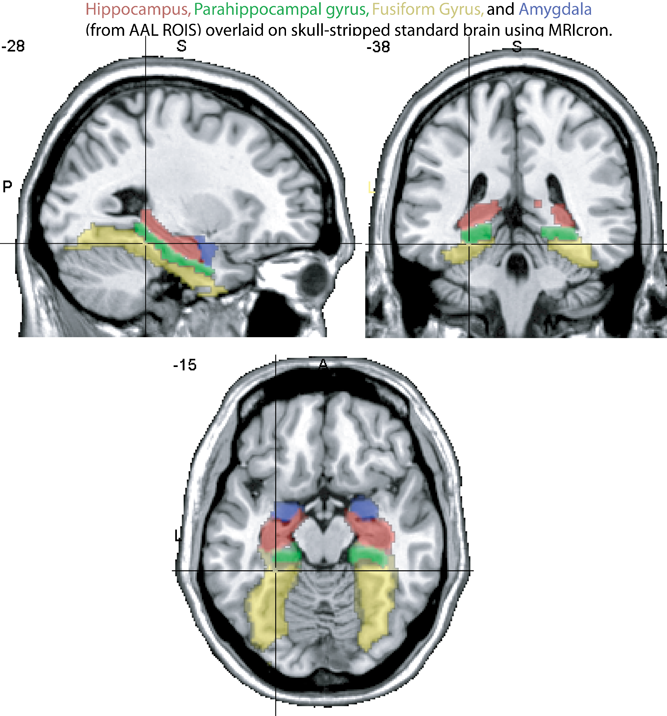 NeuroanatomyTutorial - MRC CBU Imaging Wiki